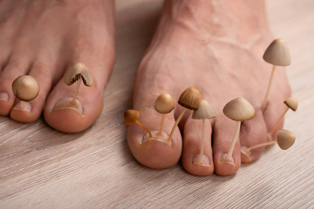 Champignons aux pieds